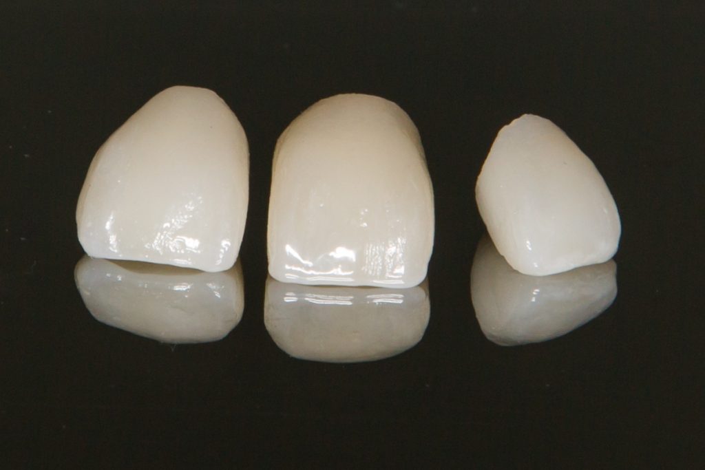 dental crowns