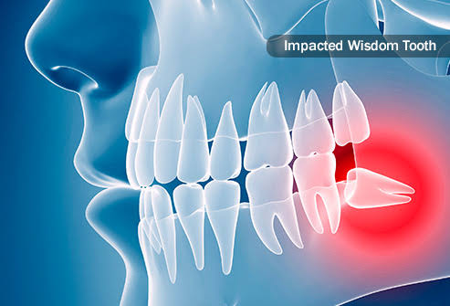 maxillofacial surgery